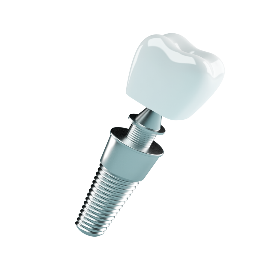 Dental Implants - Görsel 2