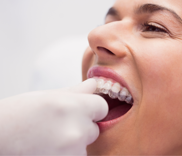 A dentist adjusts clear aligners on a smiling patient's teeth during an orthodontic consultation.